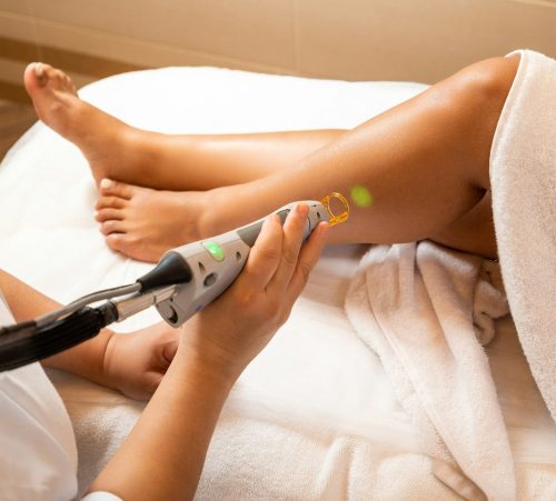 Laser Hair Removal